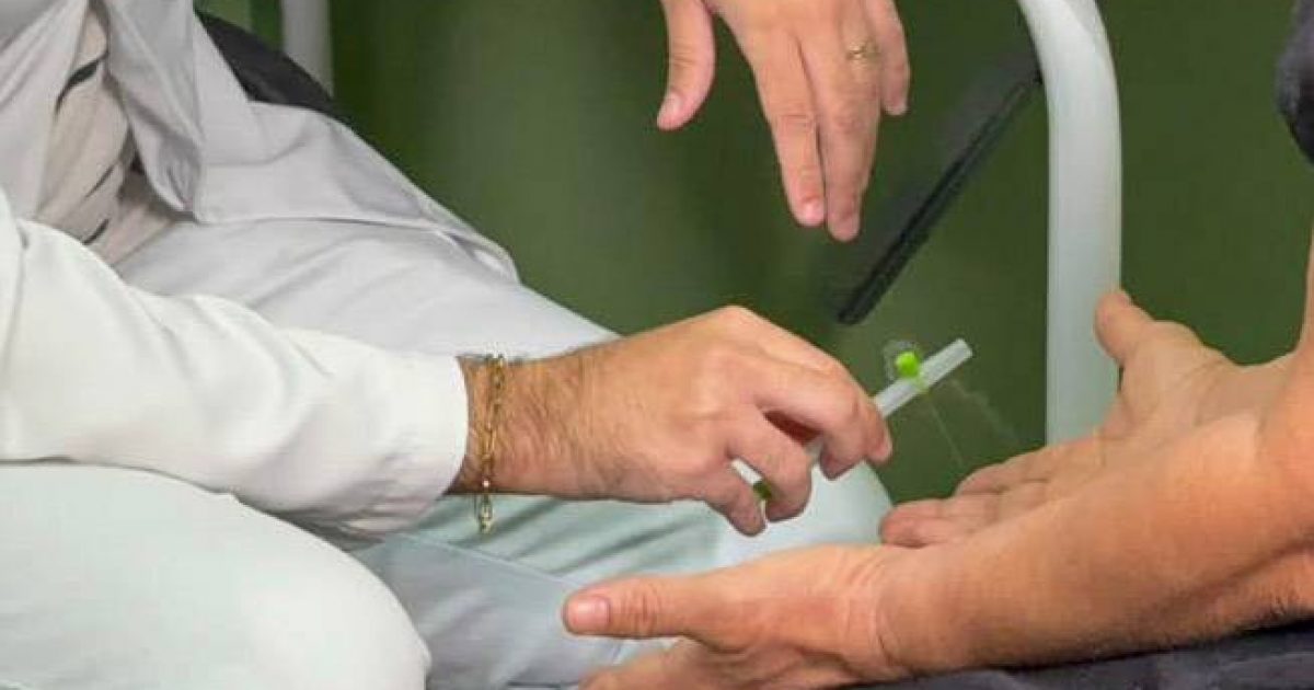 Capacitação em hanseníase amplia diagnóstico e identifica 42 novos casos em Várzea Grande